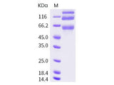 Recombinant HCoV-OC43 S1+S2 Protein (ECD, His Tag)