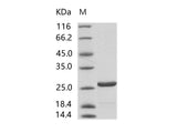 Recombinant HIV-1 p24 protein (group N, strain 06CM-U14296) (His Tag)