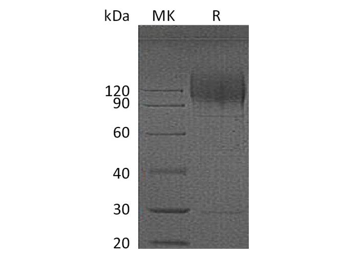 Recombinant HIV Recombinant HIV gp120 Protein (His Tag)