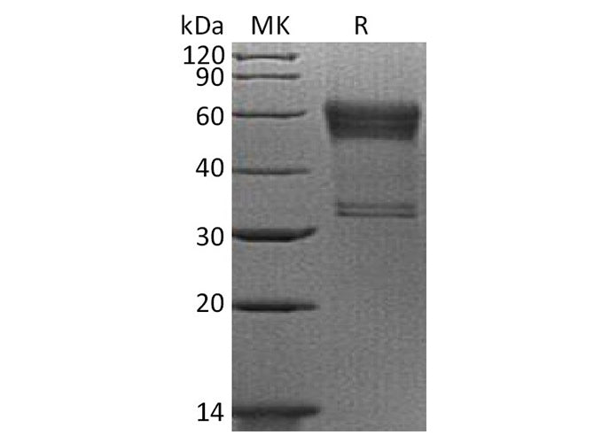 Recombinant Human 4-1BB/TNFRSF9 Protein (mFc Tag)