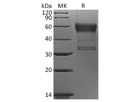Recombinant Human 4-1BB/TNFRSF9 Protein (mFc Tag)
