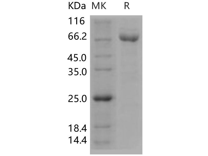 Recombinant Human A2M/CPAMD5/Alpha-2-macroglobulin Protein (His Tag)(Active)
