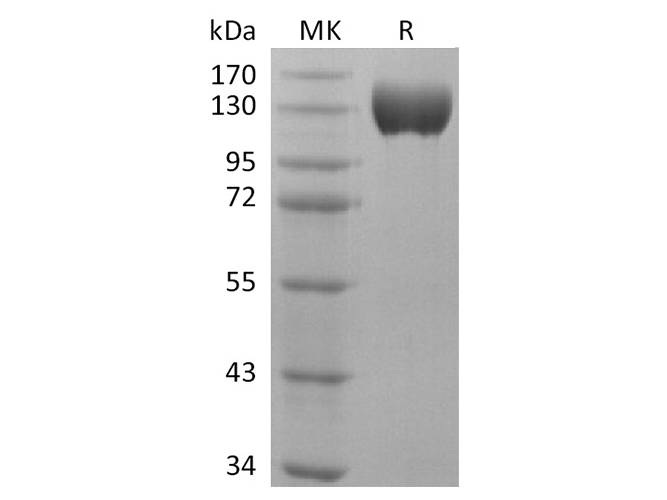 Recombinant Human ACE2 Protein (Fc Tag) Store at < -20°C