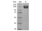 Recombinant Human ACE2 Protein (Fc Tag) Store at < -20°C