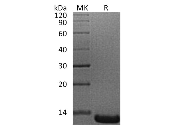 Recombinant Human ACYP1 Protein (His Tag)