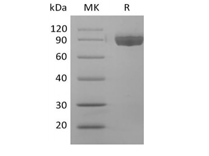 Recombinant Human Afamin/AFM (C-6His)