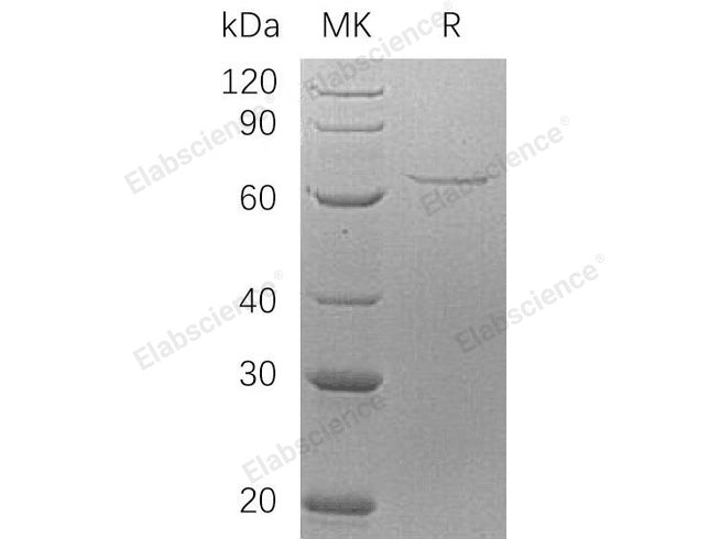 Recombinant Human AIFM1 Protein (His Tag)