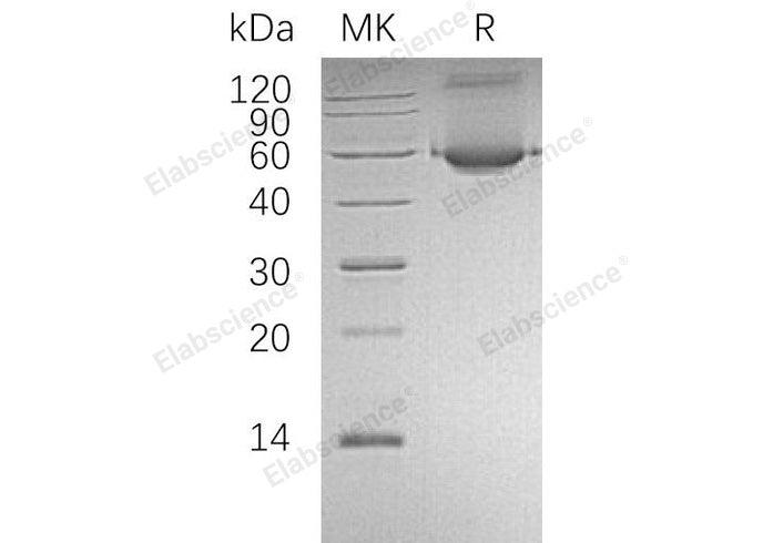 Recombinant Human ALDH1A1/ALDC Protein (His Tag)