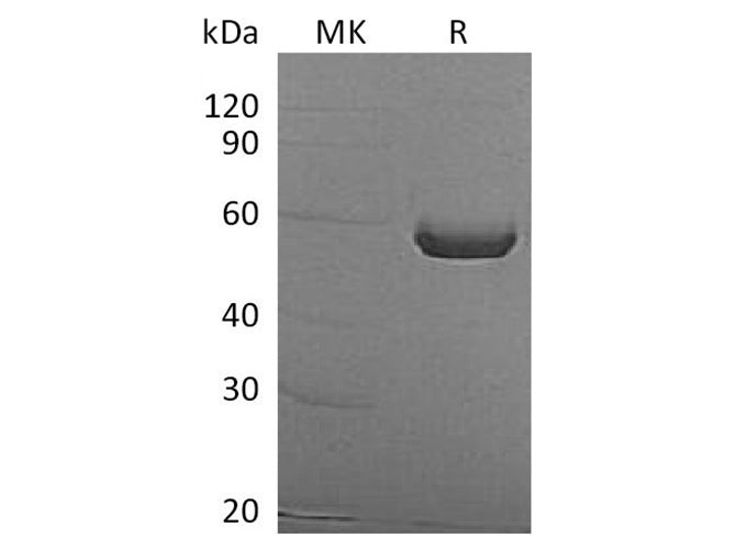 Recombinant Human ALDH1A3 Protein (His Tag)