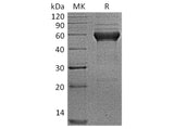 Recombinant Human ALK-1/ACVRL1 Protein (Fc Tag)