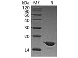 Recombinant Human Alpha-Synuclein/SNCA Protein (Active)