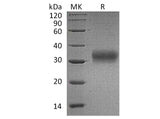 Recombinant Human AMBP/Alpha 1 Microglobulin Protein (His Tag)