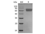 Recombinant Human AMIGO2 Protein (aa 40-393, His Tag)