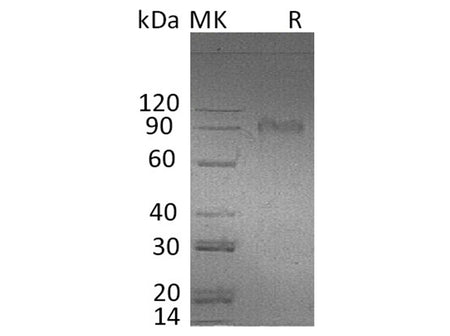 Recombinant Human AMIGO2 Protein (Fc Tag)
