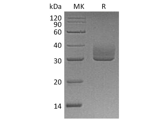 Recombinant Human ANGPTL3 Protein (His Tag)