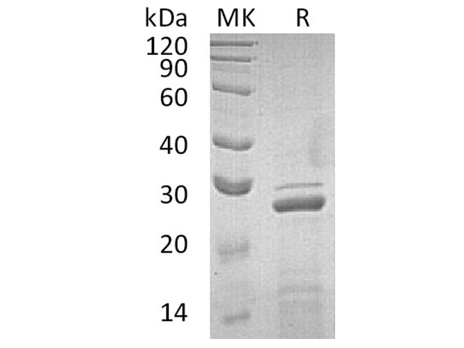 Recombinant Human Apolipoprotein A-I/ApoAI Protein
