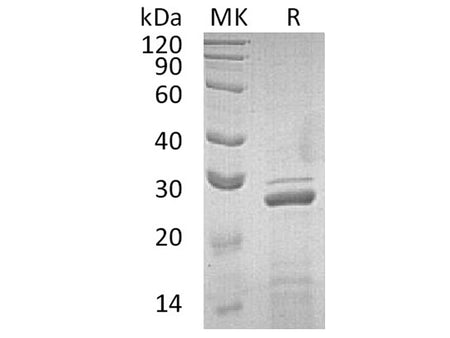 Recombinant Human Apolipoprotein A-I/ApoAI Protein