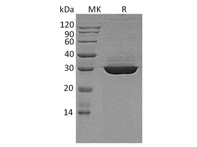Recombinant Human Apolipoprotein A-I/ApoAI Protein (aa 19-267, His Tag)