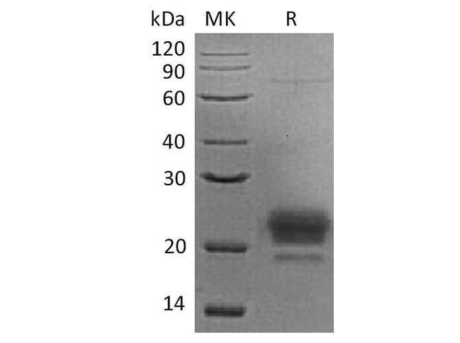 Recombinant Human APOM Protein (His Tag)