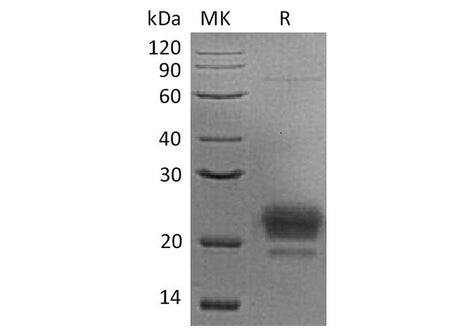 Recombinant Human APOM Protein (His Tag)