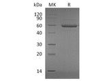Recombinant Human APRIL/TNFSF13 Protein (His & Flag Tag)