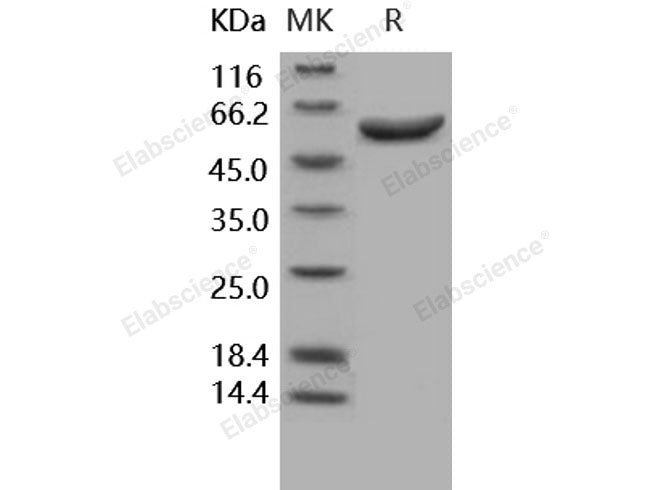 Recombinant Human Arylsulfatase A/ARSA Protein (His Tag)(Active)