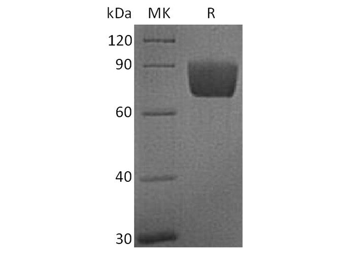 Recombinant Human B7-H4/VTCN1 Protein (Fc Tag)