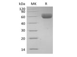 Recombinant Human Basigin/CD147 (C-Fc)