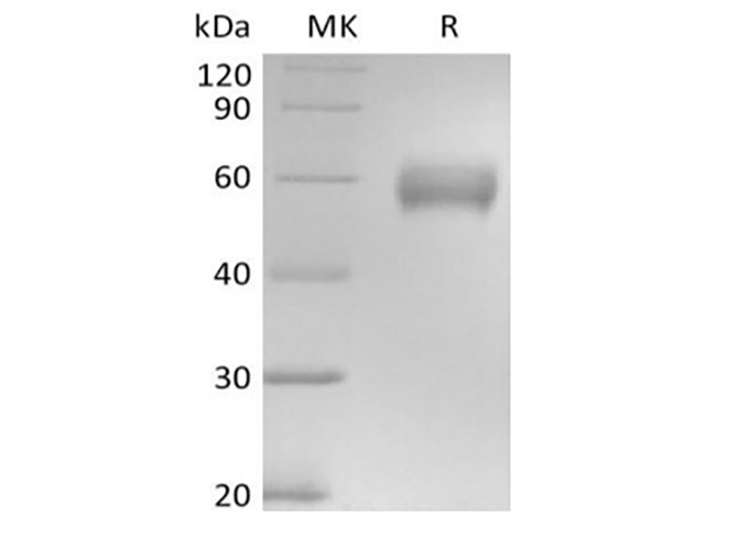 Recombinant Human Basigin/CD147 (C-mFc)