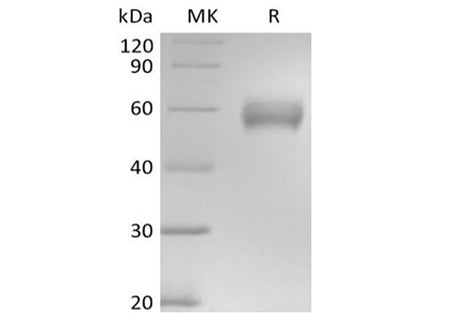 Recombinant Human Basigin/CD147 (C-mFc)