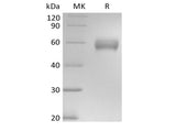 Recombinant Human Basigin/CD147 (C-mFc)