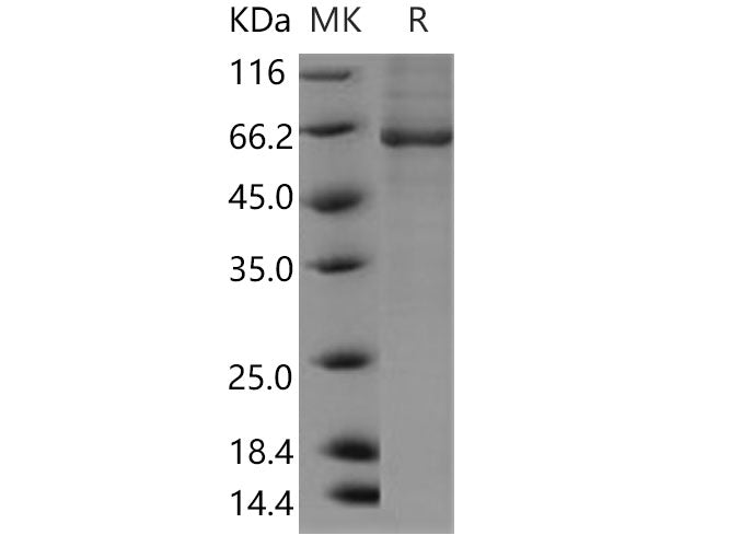 Recombinant Human BBOX1/Gamma-BBH Protein (His & GST Tag)