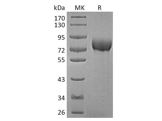 Recombinant Human BCAM Protein (His Tag)