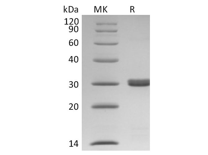 Recombinant Human BCL2L1/Bcl-XL Protein (His Tag)