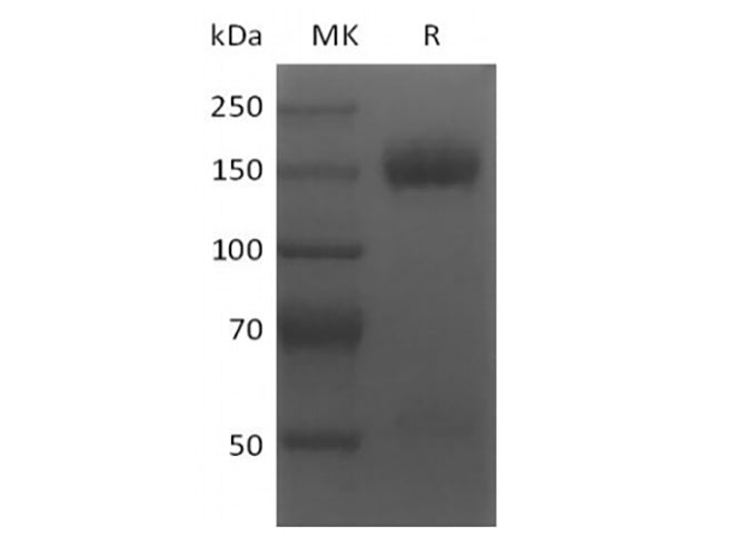 Recombinant Human BCMA/TNFRSF17 (N-6His-Flag)