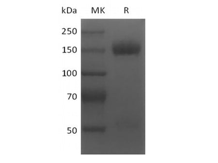 Recombinant Human BCMA/TNFRSF17 (N-6His-Flag)