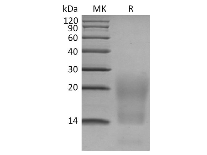 Recombinant Human BCMA/TNFRSF17 Protein (His Tag)
