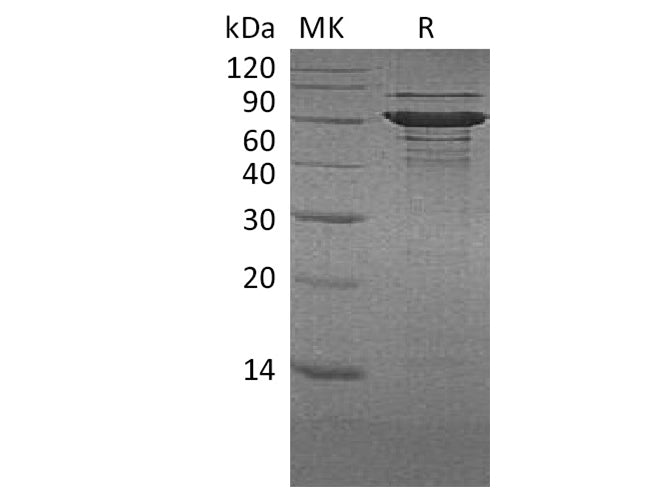 Recombinant Human BLNK/Ly-57 Protein (His Tag)