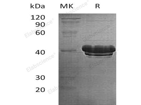 Recombinant Human Bridging Integrator 2/BIN2 Protein (His Tag)