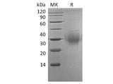 Recombinant Human BTLA/CD272 Protein (His Tag)(Active)