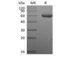 Recombinant Human Butyrophilin Subfamily 3 Member A1/BTN3A1 (C-Fc-Avi) Biotinylated