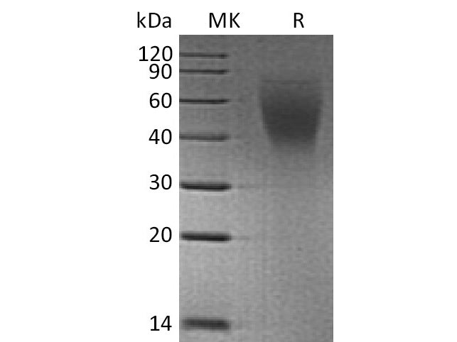 Recombinant Human CA125/MUC16 (C-6His)