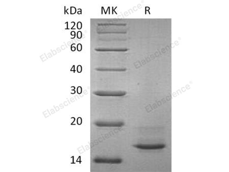Recombinant Human Calcitonin/CALCA Protein (His Tag)