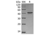 Recombinant Human CAMK1/CaMKI-alpha Protein (His Tag)