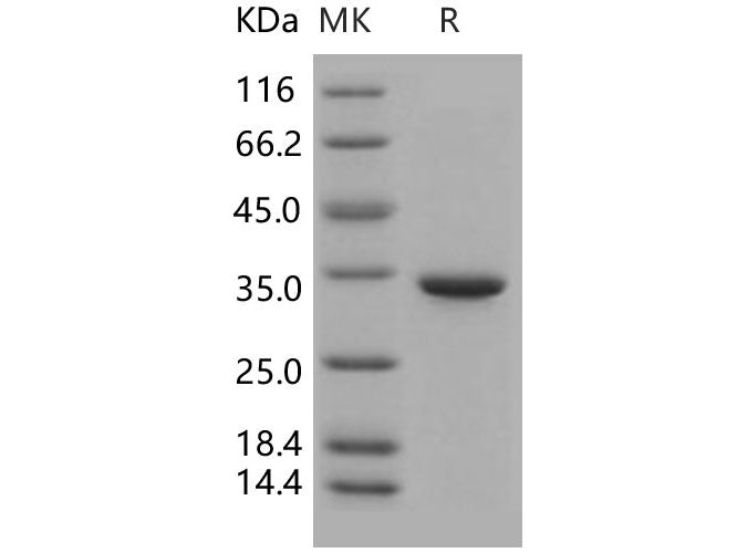 Recombinant Human Carbonic Anhydrase 5B/CA5B Protein (His Tag)(Active)