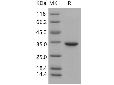 Recombinant Human Carbonic Anhydrase 5B/CA5B Protein (His Tag)(Active)