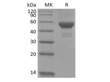 Recombinant Human Carbonic Anhydrase IX/CA9 (C-6His)