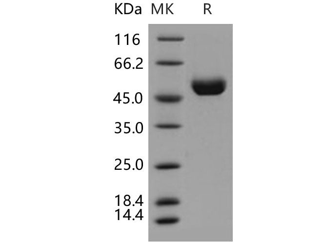 Recombinant Human Cathepsin D/CTSD Protein (His Tag)(Active)