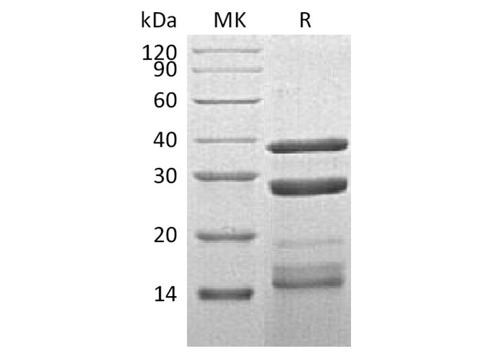 Recombinant Human Cathepsin S/CTSS Protein (His Tag)(Active)