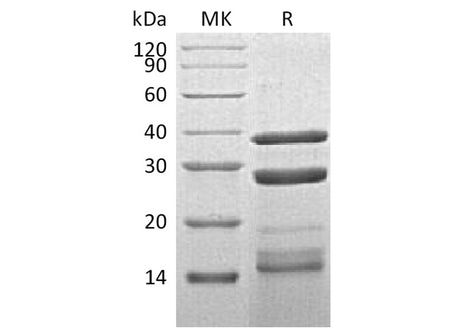 Recombinant Human Cathepsin S/CTSS Protein (His Tag)(Active)